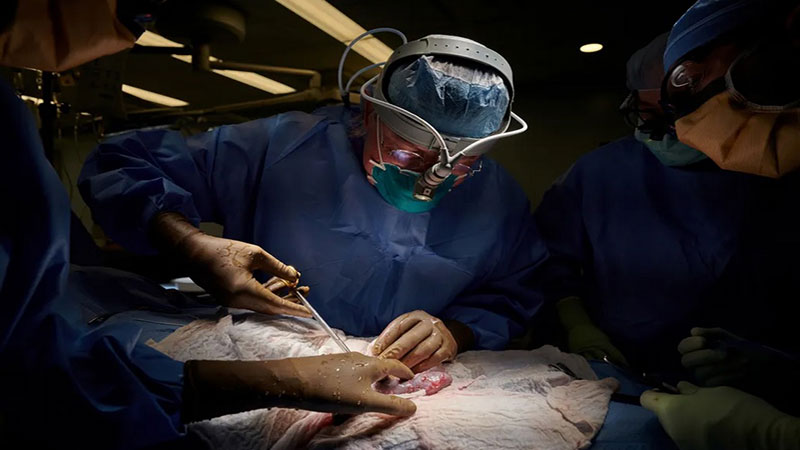 پیوند کلیه خوک به انسان برای دومین بار