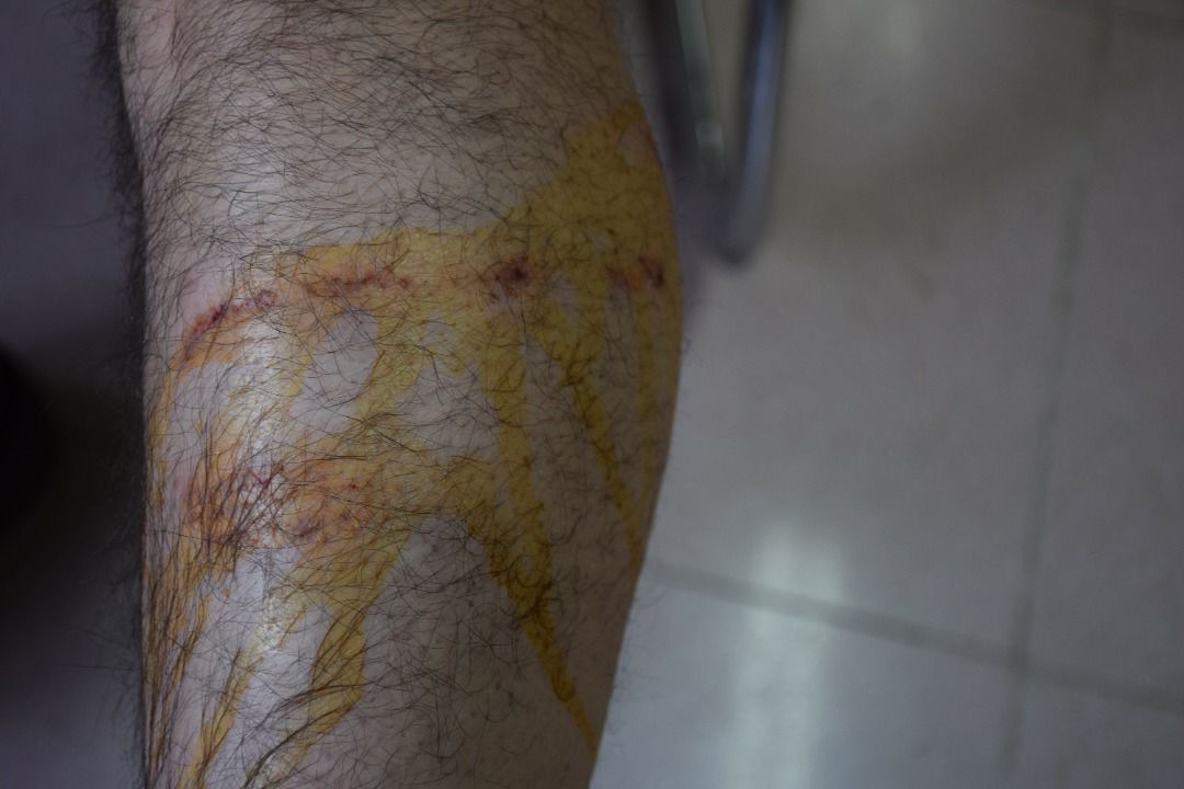 گازگرفتگی سک مدیر کل دامپزشکی اردبیل