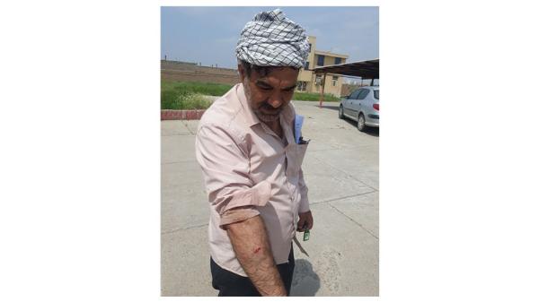 حمله سگ به واکسیناتور شبکه دامپزشکی شهرستان سرخس